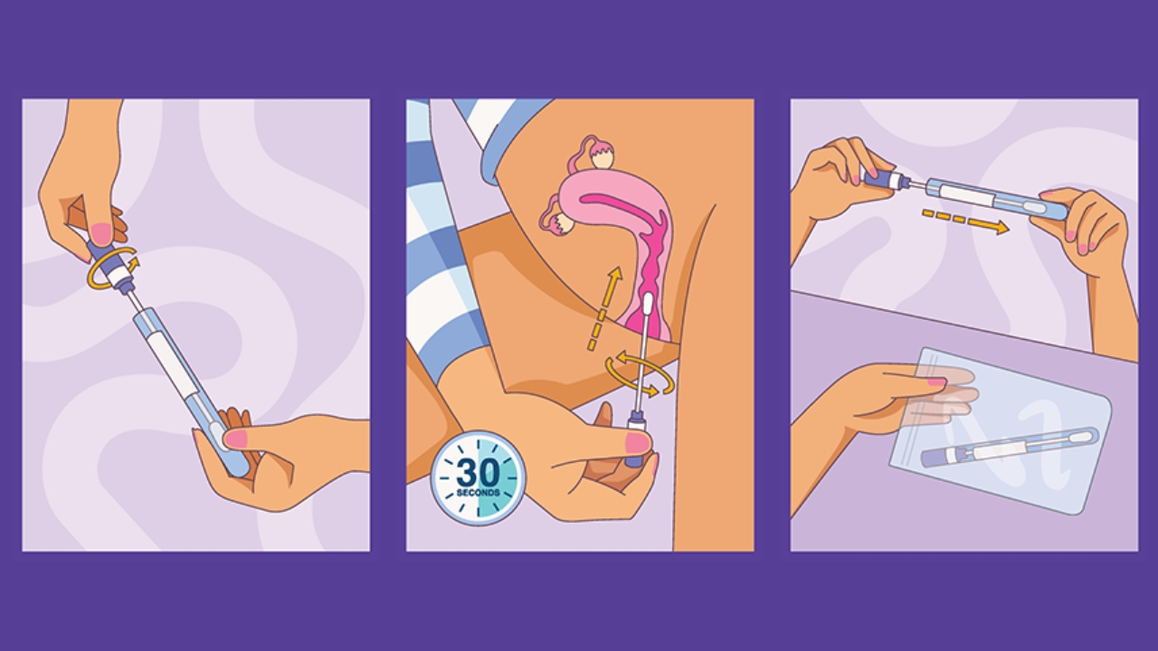 insert a swab a few centimetres into your vagina and rotate it for 20 to 30 seconds.